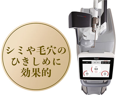 PQX (ピコレーザー)